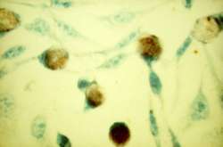Chlamydia trachomatis