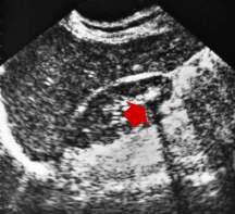 Sonogramm