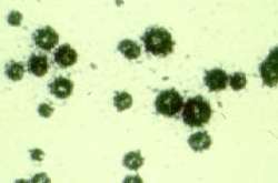 Ureaplasma urealyticum
